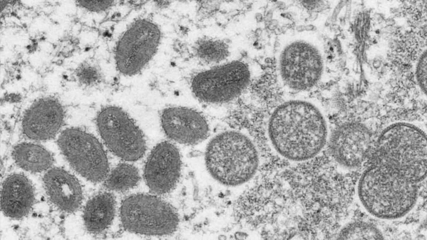 Monkey pox: 33 confirmed cases in France