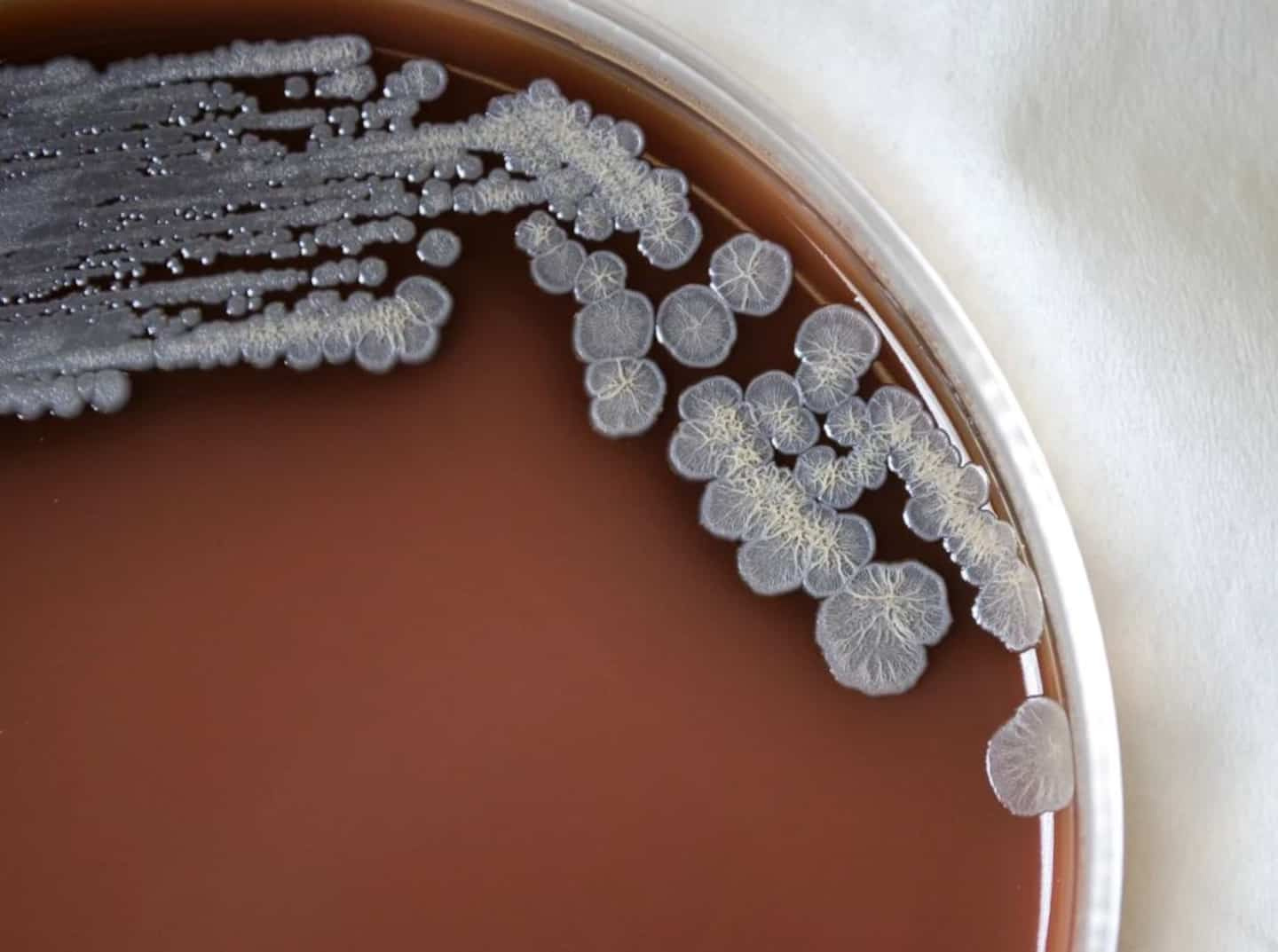 A bacterium causing a serious infectious disease detected in the United States