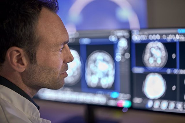PRESS RELEASE: Philips bets on AI in its advanced diagnostic imaging solutions at ECR 2023
