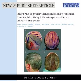 STATEMENT: New technology transforms baldness treatment using beard and body hair