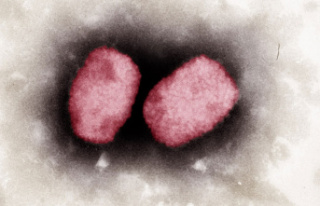 Nigeria: 21 confirmed cases of monkeypox, including...