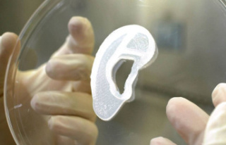 A surgeon grafted an ear implant printed from human...