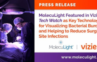 RELEASE: MolecuLight Featured in Vizient Tech Watch...